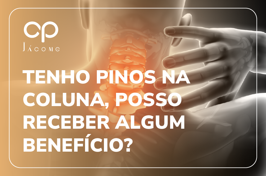 Especialistas em Direito Previdenciário explicam que pessoas que passaram por cirurgia na coluna e possuem pinos podem, sim, ter direito a benefícios do INSS — como auxílio-doença, aposentadoria por invalidez, auxílio acidente ou, em casos específicos, o BPC/LOAS. No entanto, a simples existência de pinos não garante automaticamente o benefício. É necessário comprovar que a condição compromete, de forma temporária, permanente ou parcial, a capacidade de trabalho do segurado. A concessão depende de avaliação médica e da perícia oficial do INSS, além da apresentação de laudos, exames e documentação adequada. Também é essencial verificar se o segurado ainda possui qualidade de segurado ou está no período de graça no momento do fato gerador. Por isso, contar com orientação especializada pode fazer toda a diferença para evitar erros e garantir o reconhecimento do direito. Quer saber se você tem direito a algum benefício por causa da sua condição na coluna? Acesse nosso conteúdo completo e entenda todas as possibilidades. Tenho pinos na coluna, posso receber algum benefício do INSS?